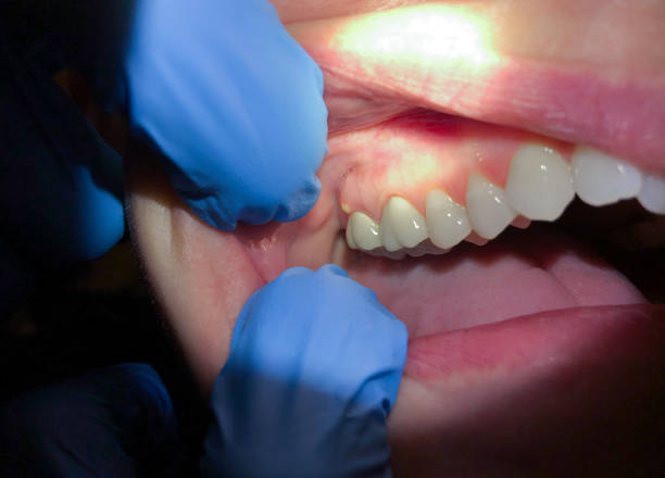 Best Emergency Treatment for Jaw Pain or Injury in Uhrichsville, OH