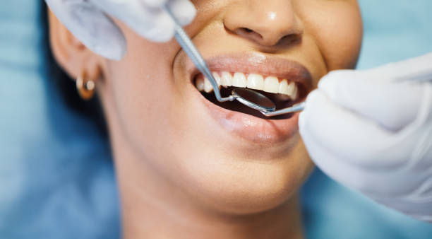 Best Broken or Chipped Tooth Repair in Uhrichsville, OH